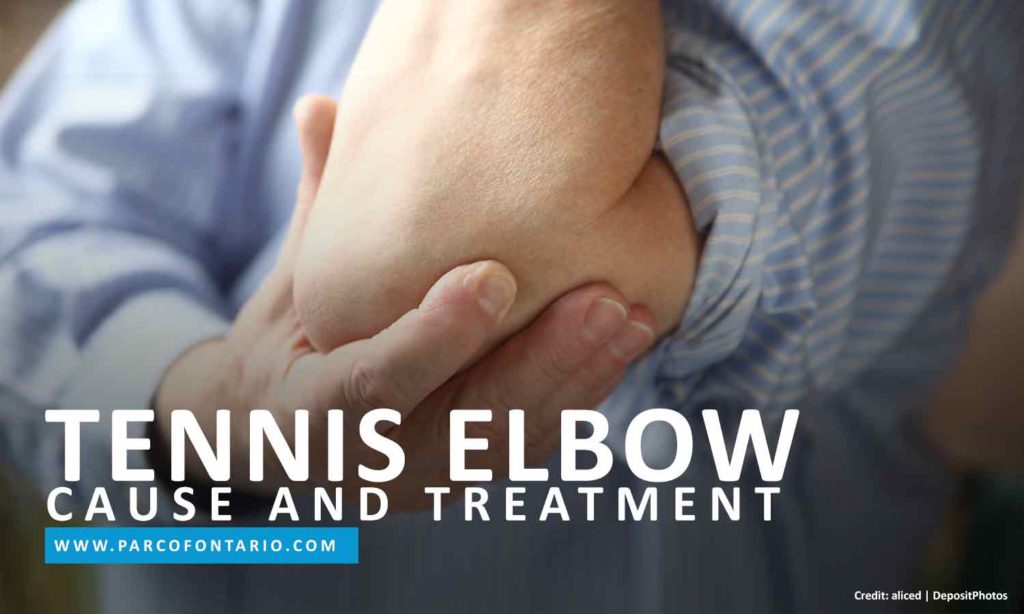 Tennis Elbow Cause And Treatment The Physiotherapy And Rehabilitation