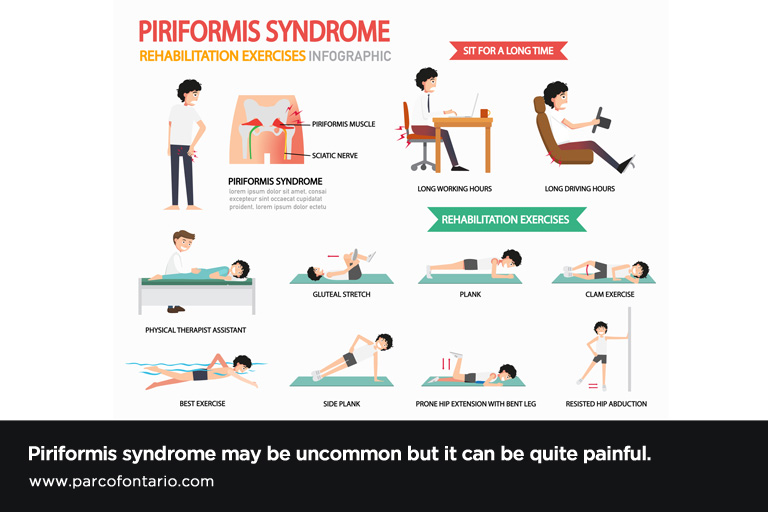 Piriformis Problems? Help!  Piriformis syndrome exercises