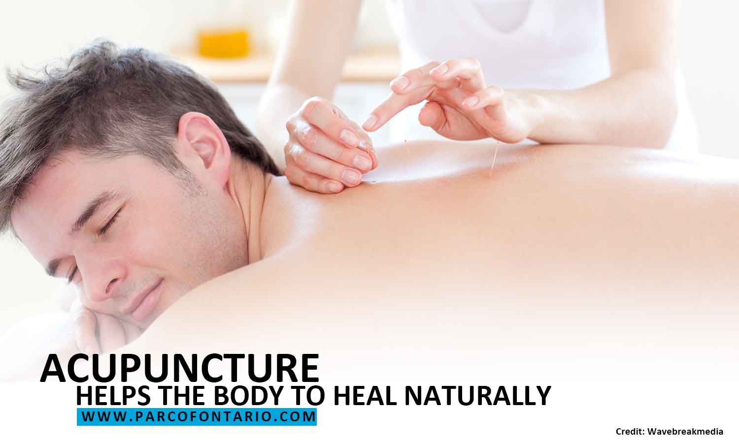 Can Acupuncture Relieve Sciatica Pain?  The Physiotherapy and  Rehabilitation Centres