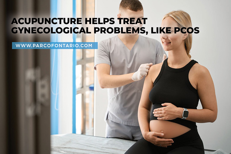 Acupuncture helps treat gynecological problems, like PCOS