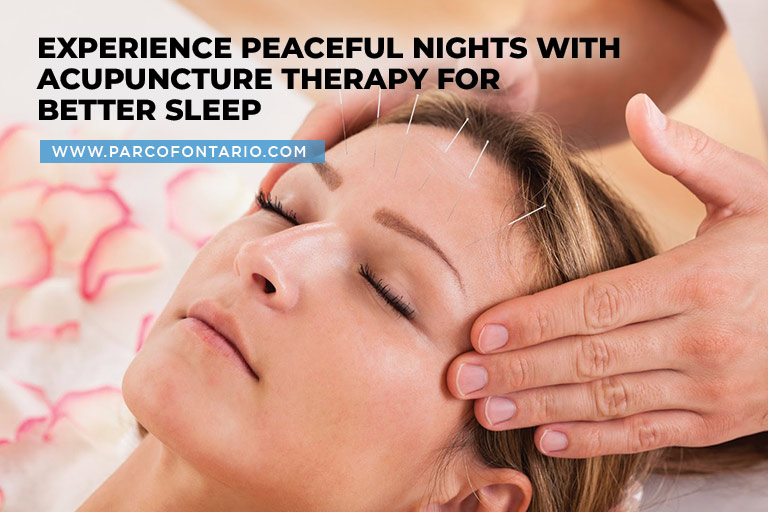 Experience peaceful nights with acupuncture therapy for better sleep