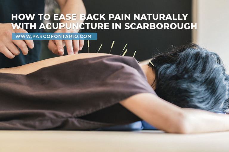 How to Ease Back Pain Naturally with Acupuncture in Scarborough