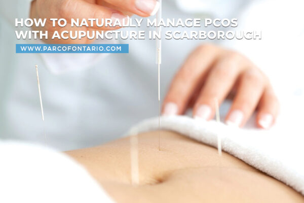 How to Naturally Manage PCOS with Acupuncture in Scarborough