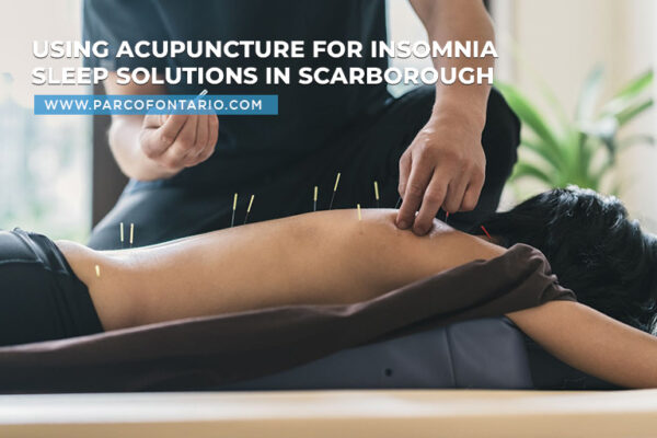 Using Acupuncture for Insomnia Sleep Solutions in Scarborough